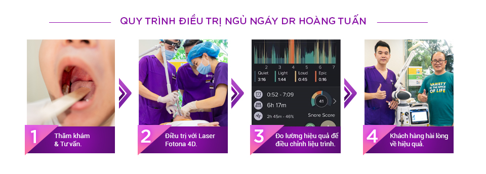 Quy trình điều trị ngủ ngáy Thẩm mỹ Hoàng Tuấn